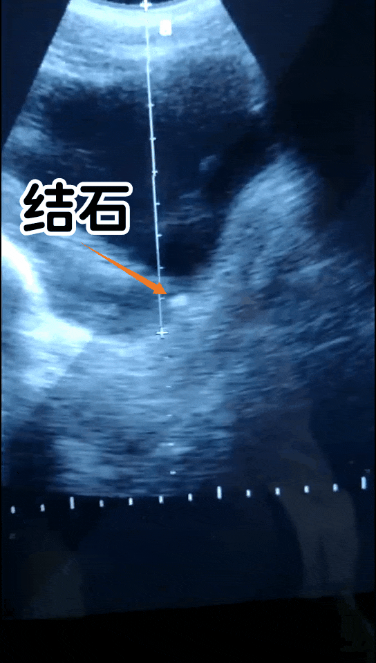 1 (1).gif