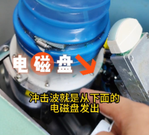 隔山打牛丨体外冲击波碎石来啦！