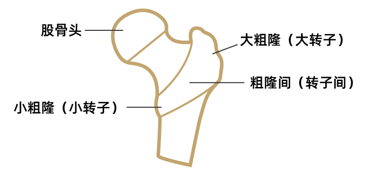 杭州城东医院,杭州城东医院骨科,粗隆间骨折,骨折,杭州骨科医院