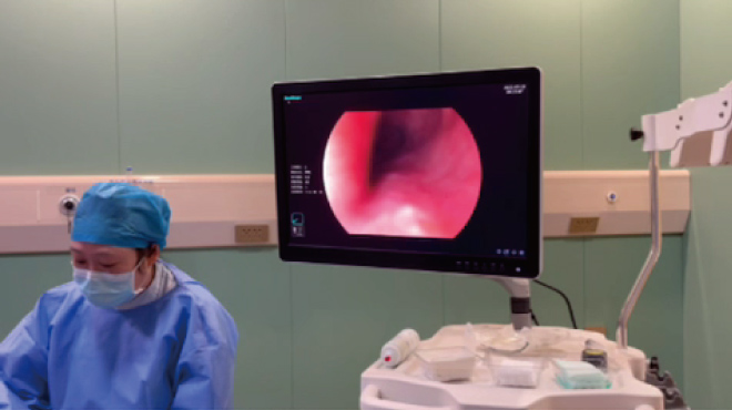 【内科（消化）科普】胃肠镜科普之反流性胃炎+肠息肉